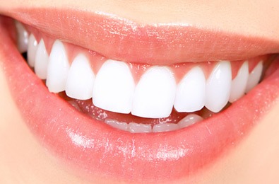 Tooth Whitening Treatment - Fort Dental Clinic