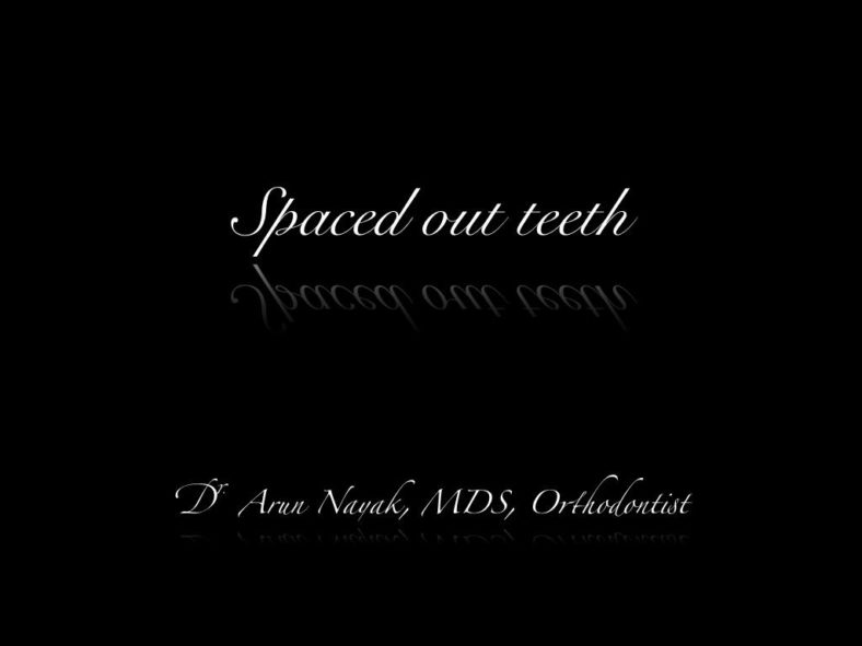 Gaps between teeth