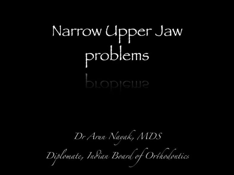 Narrow Upper Jaw Problem