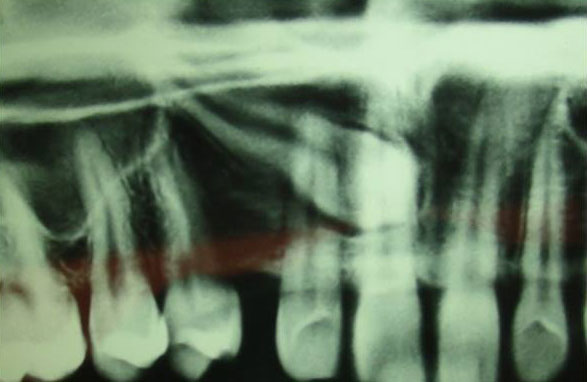 stuck-up-canines2