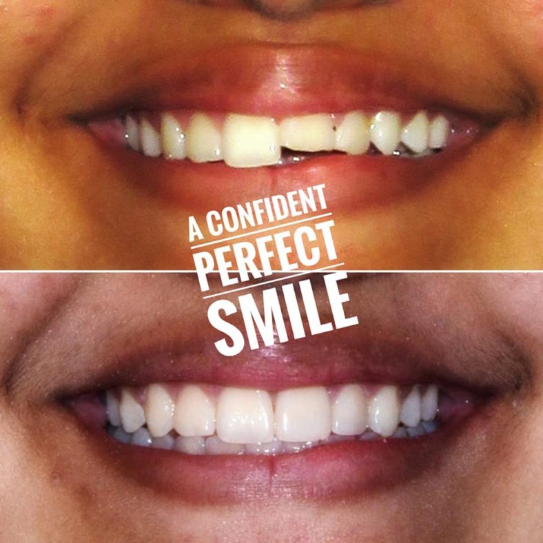 Dental Care Treatment