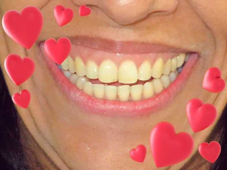 Dental Care Treatment