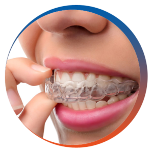 invisalign-for-adults