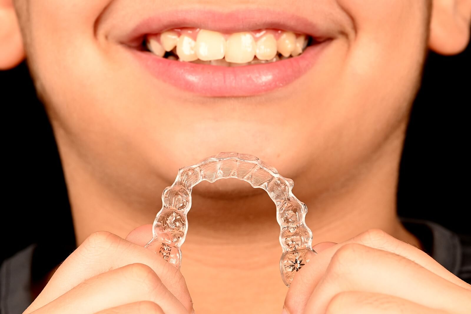 Invisalign Photo