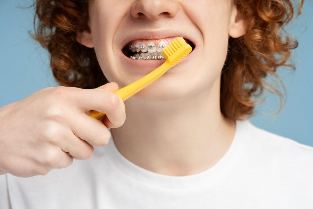Brush at 45° angle to clean above and below Brackets