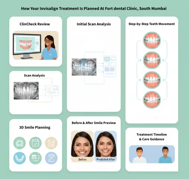 Invisalign Treatment Planning at fort dental south mumbai
