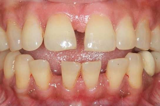 Orthodontics-Treatment1 Orthodontics-Treatment1
