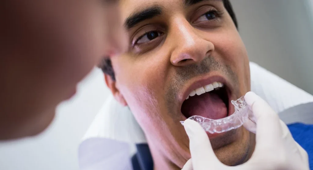 Invisalign for Athletes