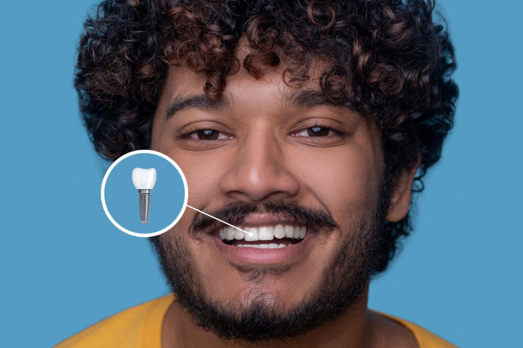 All-on-4 dental implant patient