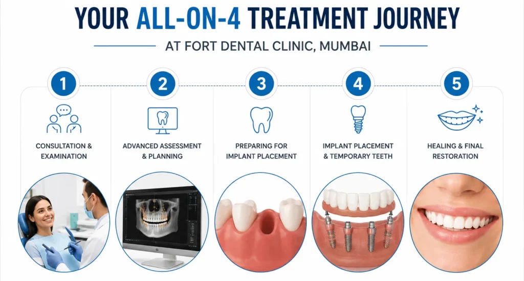 All-on-4 treatment journey at Fort Dental Clinic, Mumbai