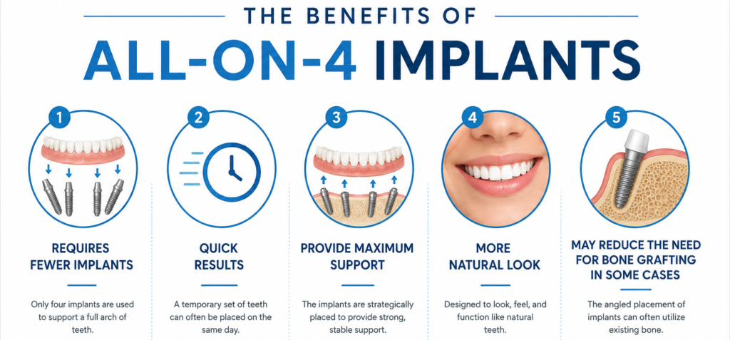 benefits of all-on-4 implants