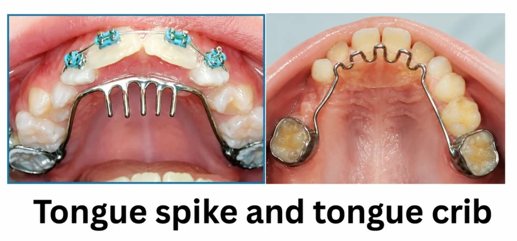 Tongue spike and tongue crib